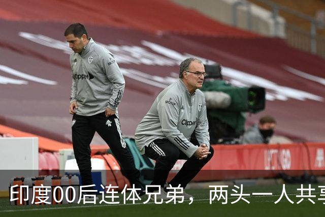 印度00后连体兄弟，两头一人共享下半身，配合太默契：让我们分开也不分！
